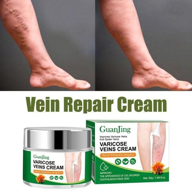 GuanJing Varicose Veins Cream - Producto principal